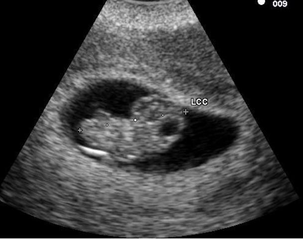 Heart develops right and left chambers