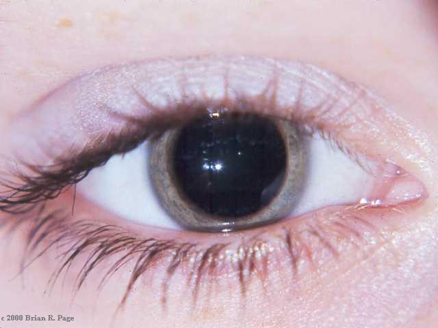 Heart beats Regularly. eyes begin to form.