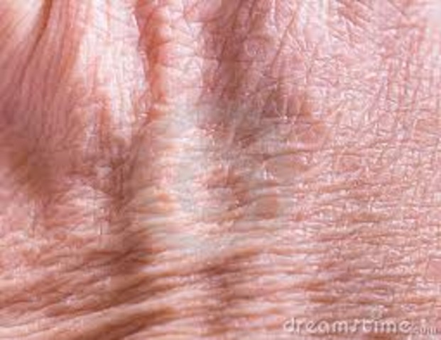 skin starts to become wrinkled