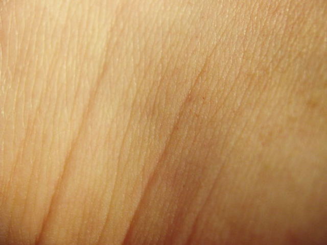 Skin starts to become wrinkled.