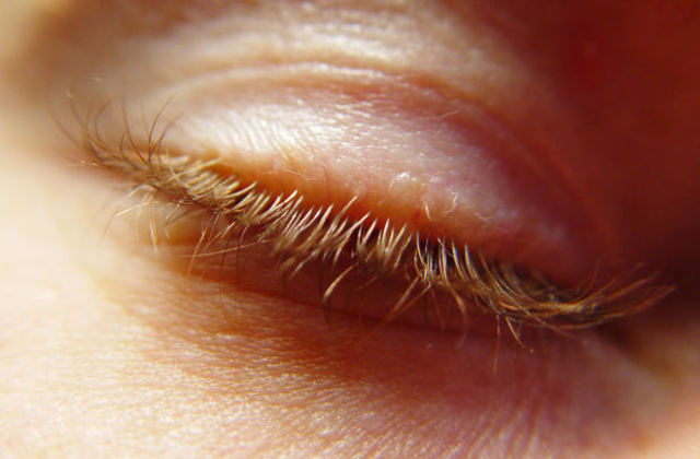 6 to 9 month old fetus