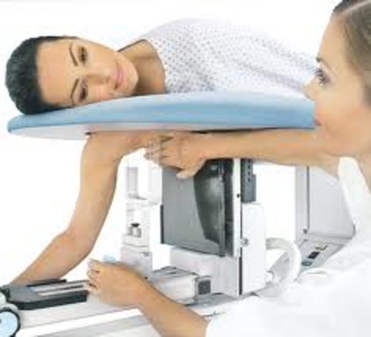 Clinical Breast Exam