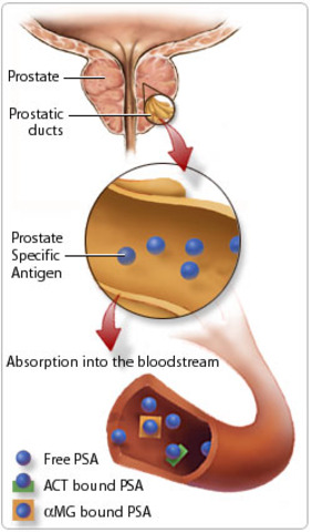 Prostate Specific Antigen Blood Test or Digital Rectal Exam