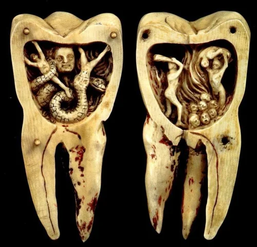 Origen de las caries y dolor dental