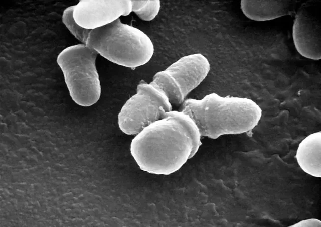 Pitiriasis Versicolor