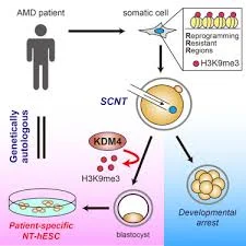 Human embryonic stem cells created by somatic cell nuclear transfer