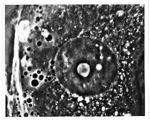 Removal of Tissue Sample