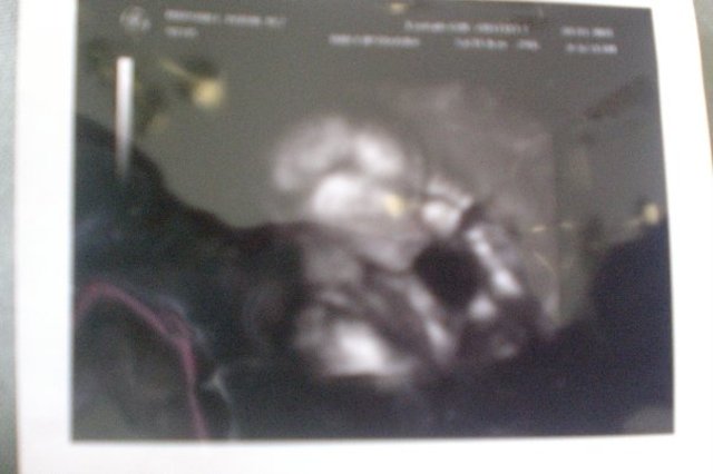 Me and my fiance found out that we were expecting our first child!!!!