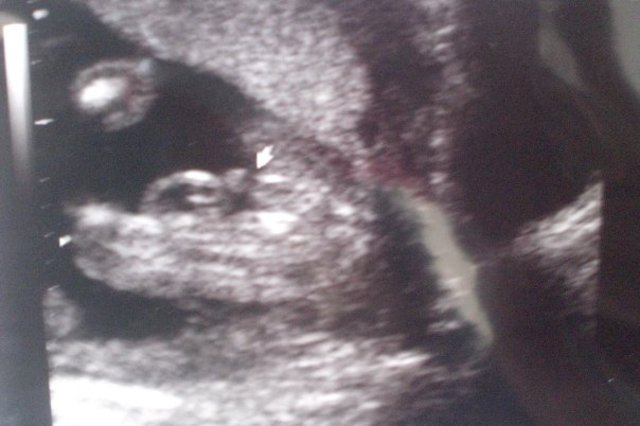 Found out I was having a BOY!