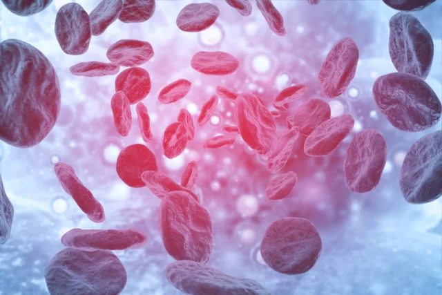 Blood Disorders and Sickle Cell Anemia
