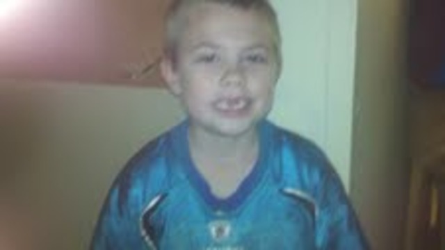 Lost my two front teeth!