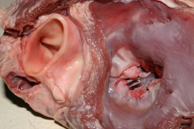 Heart develops right and left chambers.