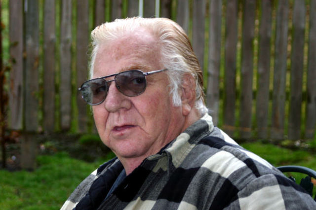 Aging becomes more Noticeable and Progresses Rapidly.