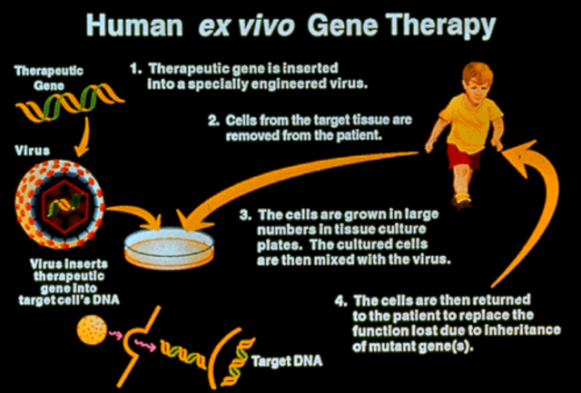 First Gene Therapy Procedure