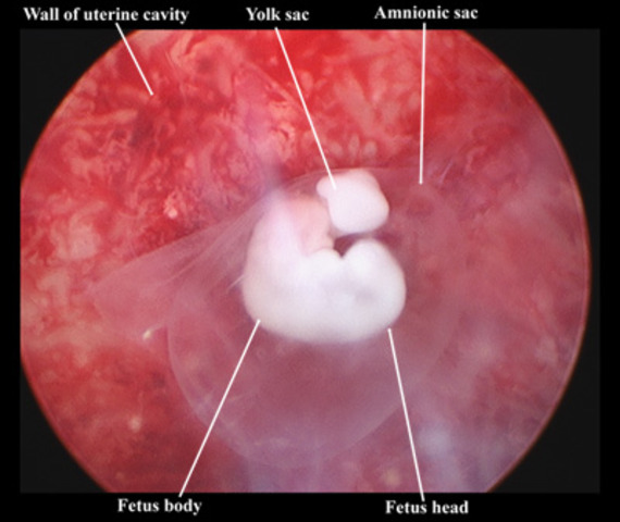 Congress Bans All Federally Funded Fetal Tissue Research