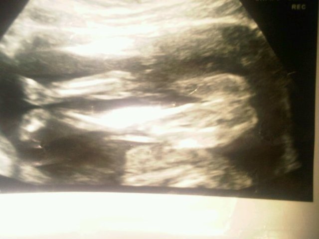 Found out that I was having a GIRL! Also moved to Wixom, MI with my family.