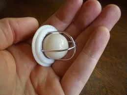 First Artificial Heart Valve Implant