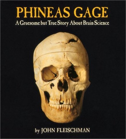 Phinease Gage Quiz
