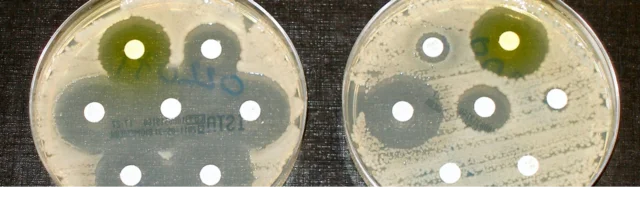 La teoría microbiana