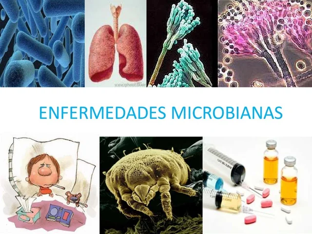 La Teoría Microbiana Sin Pasteur Y Koch