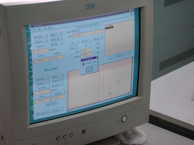 el UNIX es usado sobre 16 bits.el kemel es reescrito en C.