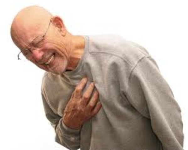 Heart attack