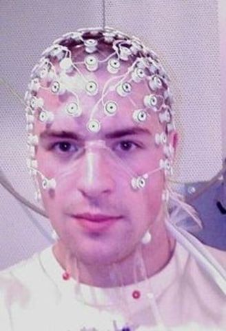 Hans Berger Invents the Electroencephalogram (EEG)