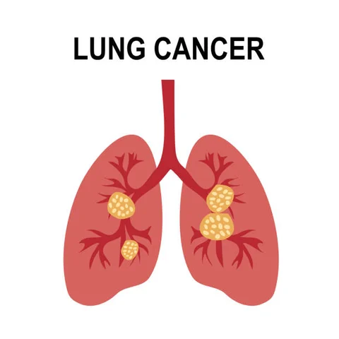 New Vaccine Exceptions