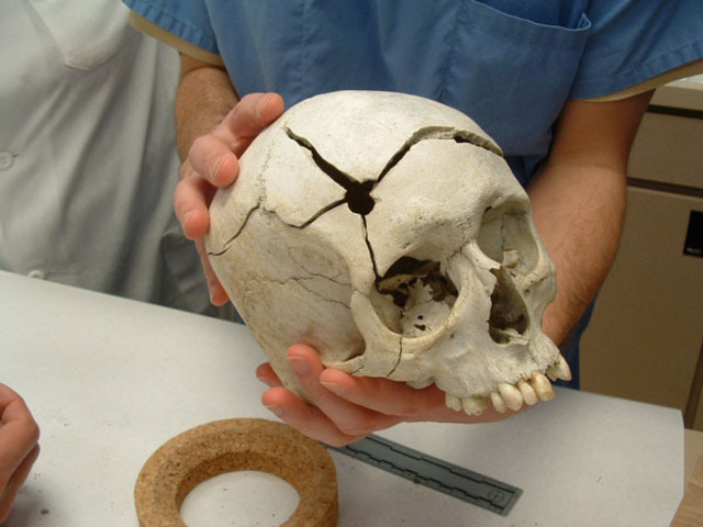 Forensic Anthropology in Peace Support Operations.  In Law enforcement within the framework of peace support operations, edited by Roberta Arnold. Koninklijke Brill NV: Leiden, The Netherlands, pp. 179-196.  (with Mercedes Doretti)