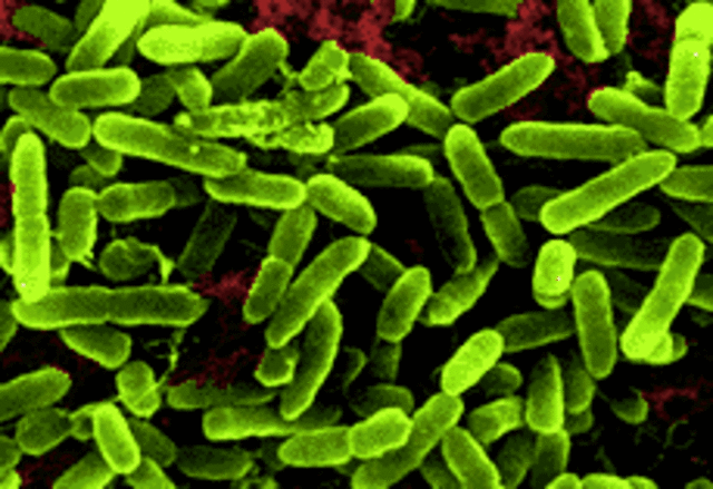 Anaerobic, Heterotrophic, and Prokaryotes (4BYA)