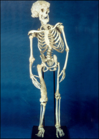 Supposedly tries to buy the "Elephant Man"s (John Merrick) skeleton for a reported one million dollars.