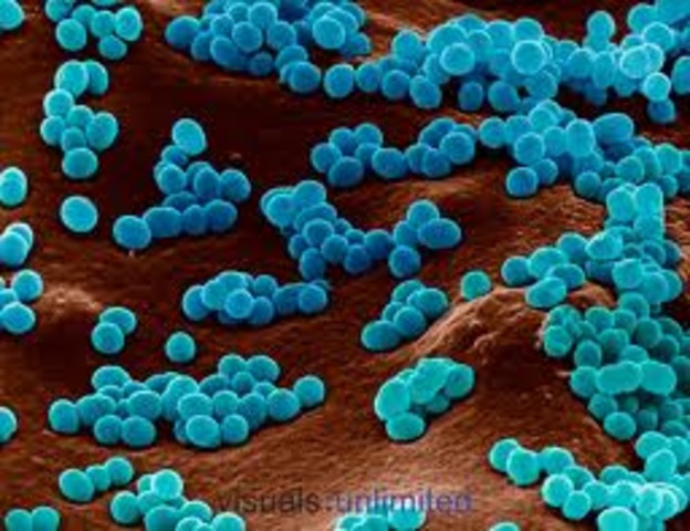 (1.5 BYA) Aerobic Prokaryote