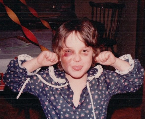 I get kicked in the face by a pony. OUCH!!!