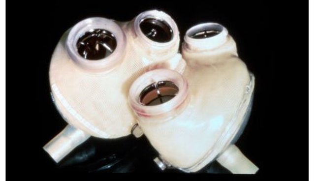 U.S. Health- First artificial heart recipient comes home from hospital