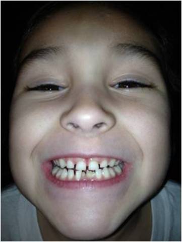 My first tooth