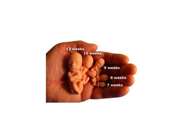 Abortion Legalized in US