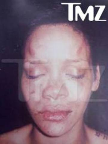 Rihanna's boyfriend Chris Brown beat her up