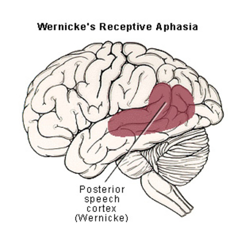 Wernicke's Cerebral Localization of Disease