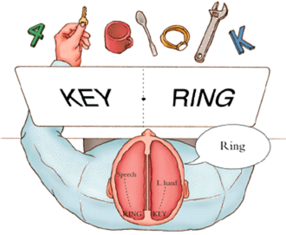 Roger Sperry's work on split-brain patients