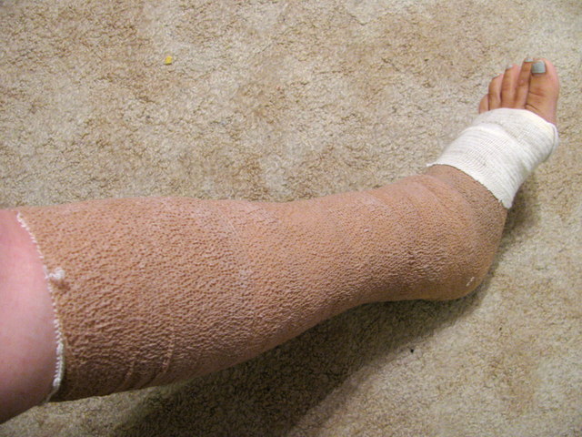 Constable Alexander Fitzpatrick got injured