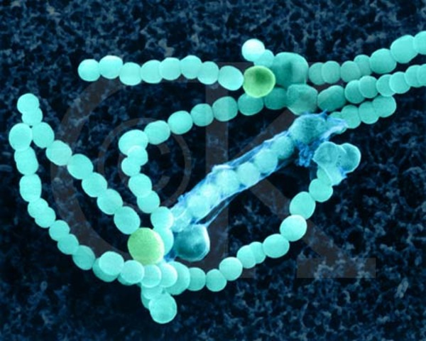 (3 BYA) Forms of life become Photosynthetic