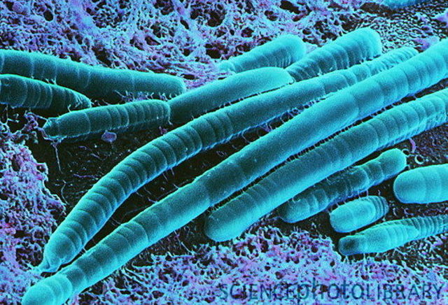 (3.5 BYA) Lyngbya Cells Roam the Earth