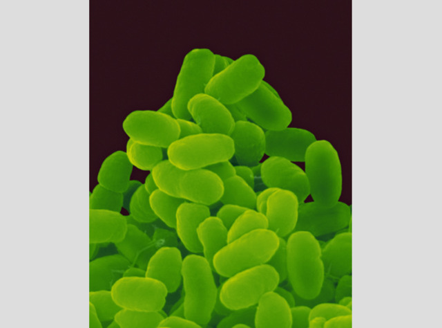 (Between 2 BYA-1.5 BYA) Aerobic Prokaryote & Endosymbiosis