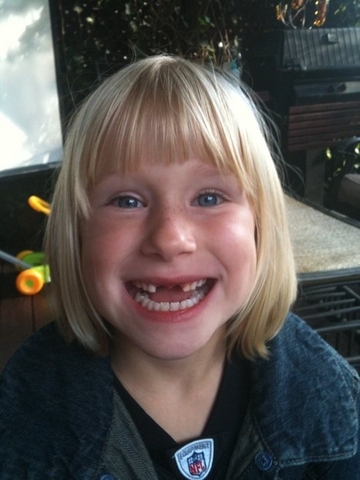 AND THE TEETH JUST KEEP COMIN' OUT!