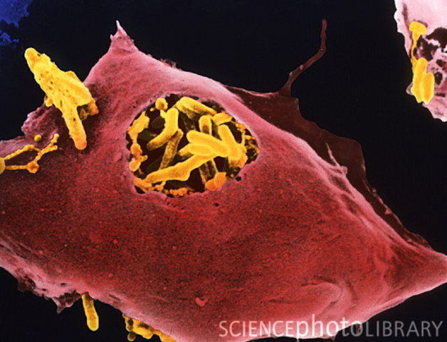 Tuberculosis and Tetanus Vaccines