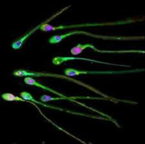 Anton Van Leeuwenhoek