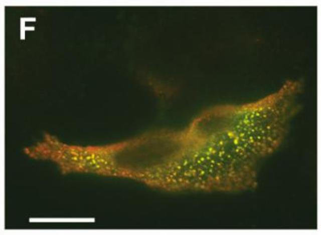 Eduard Buchner Receives Nobel Prize