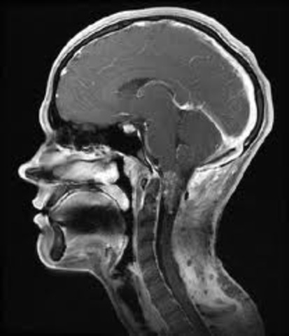 Magnetic resonance imaging