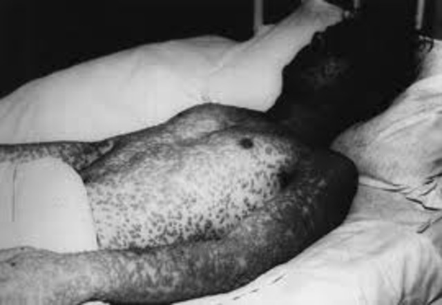 an epidemic of smallpox,brought by europeans, kills many native Americans on the New England coast