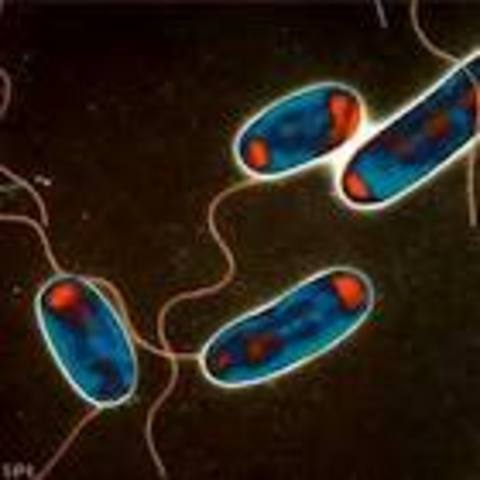 Legionnaires Disease strikes 182, kills 29